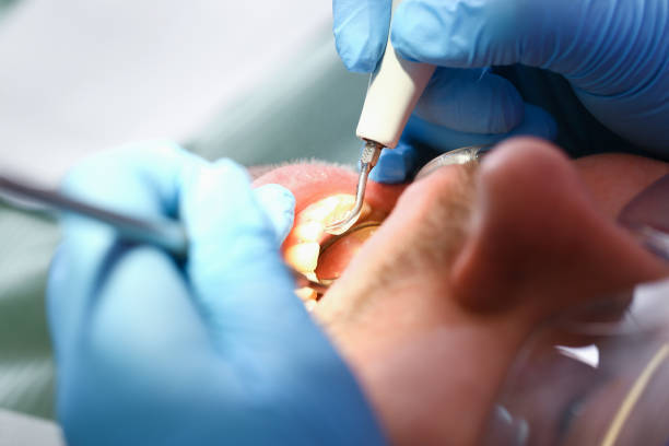 Best Dentist for Tooth Abscess  in Waldwick, NJ